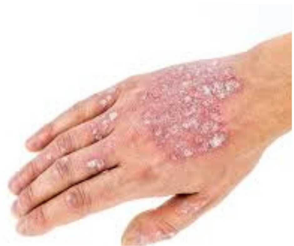 كريم ديرموفيت