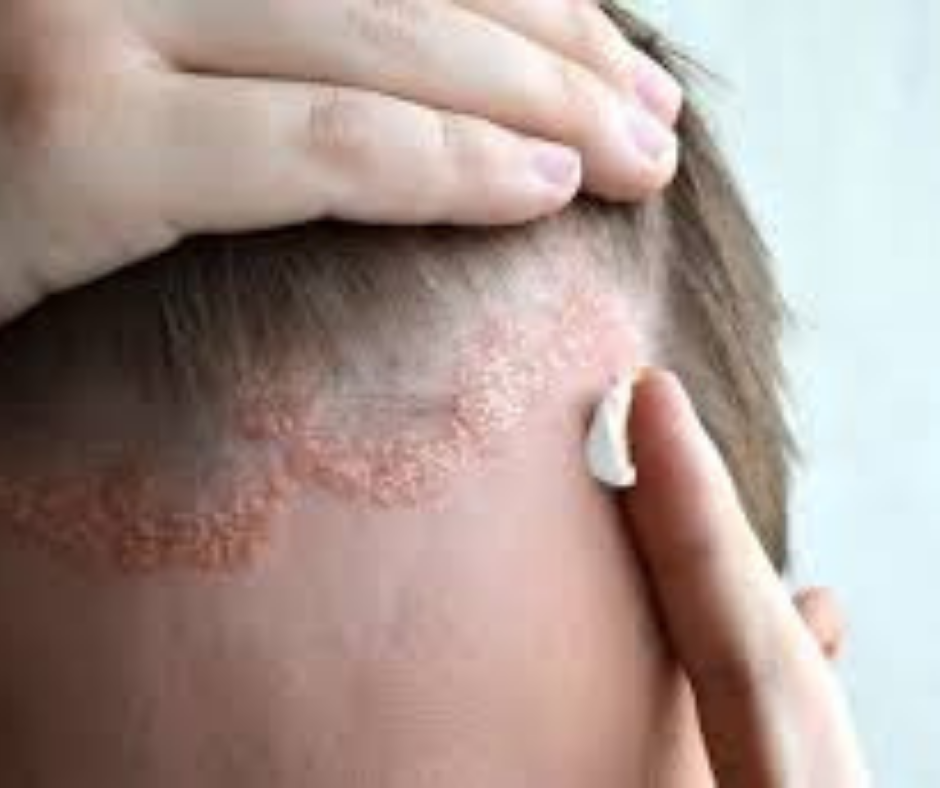 كريم ديرموفيت