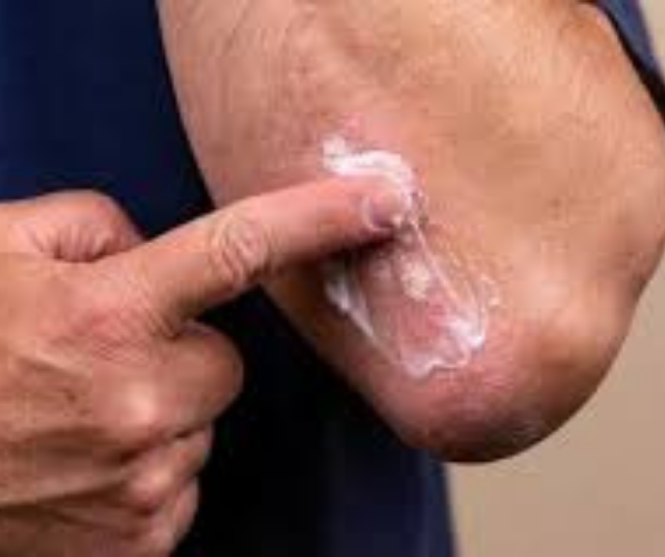 كريم ديرموفيت