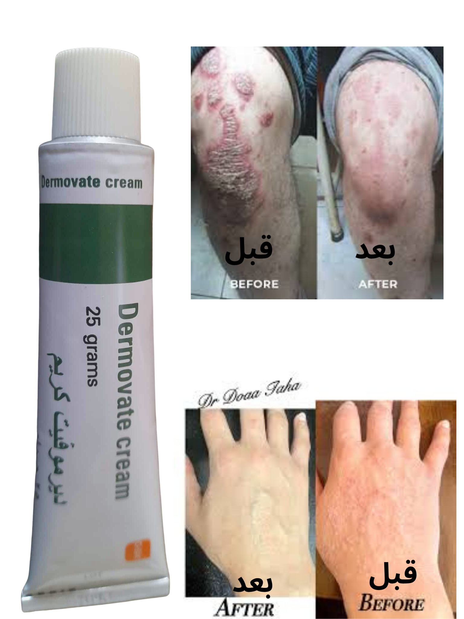 كريم ديرموفيت