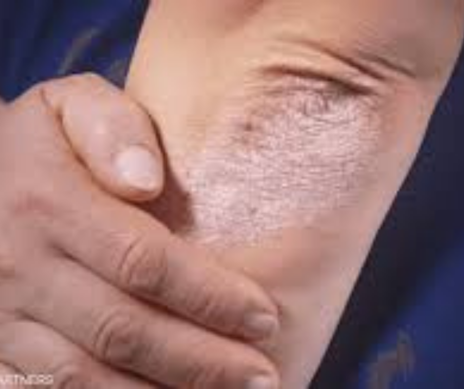 كريم ديرموفيت